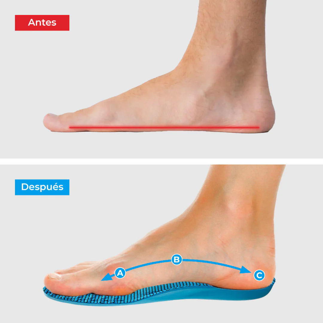 COMFYFEET™ – Plantillas ortopédicas con soporte de arco [Promo 2 X 1]